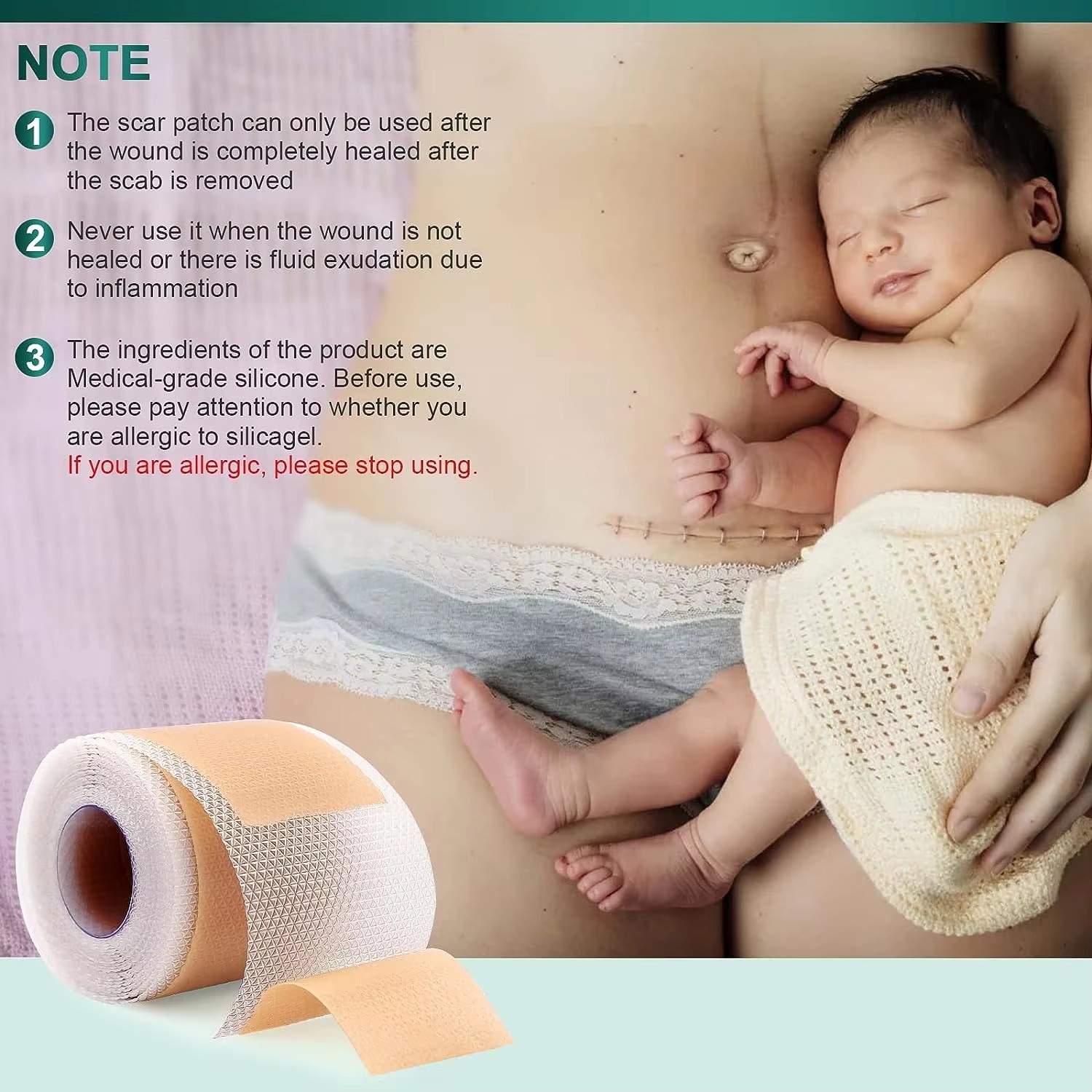 50/100/150 Cm Siliconen Gel Li - Medical Tape recensie en prijs