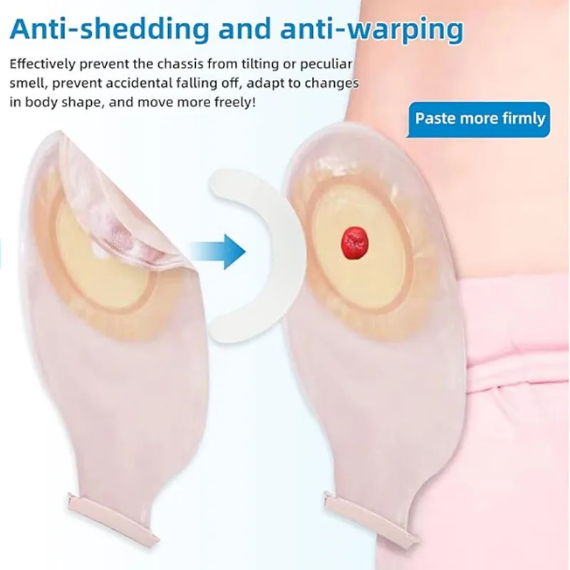 Medische stomazak versteviging - Medical Tape recensie en prijs